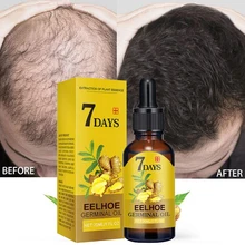 Ginger Hair Growth Essential Oil Serum Anti Hair Loss ProductsFast Grow Prevent Hair Thinning Dry Frizzy Damaged Hair Care 20ml