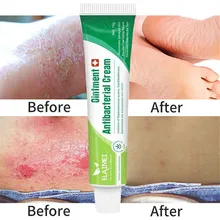 

Herbal Ointment Antibacterial Cream Eczema Psoriasis Cream Anti-itch Relief Eczema Skin Rash Urticaria Desquamation Treatment