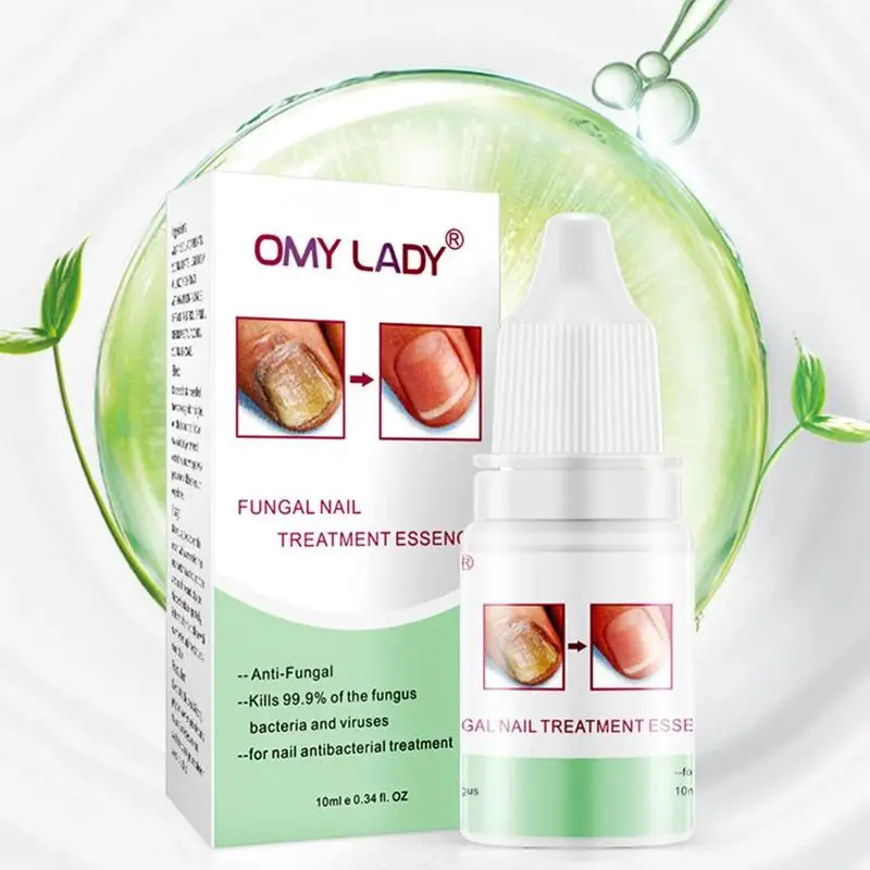 10ml Nail Care Solution Antifungal Treatment For Hyperthyroidism Infection Herbal Formula Care Solution