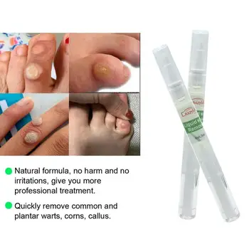 

Wart Treatment Removal of Warts Liquid From Skin Tags Removing Against Moles Remover Wart Removal Liquid