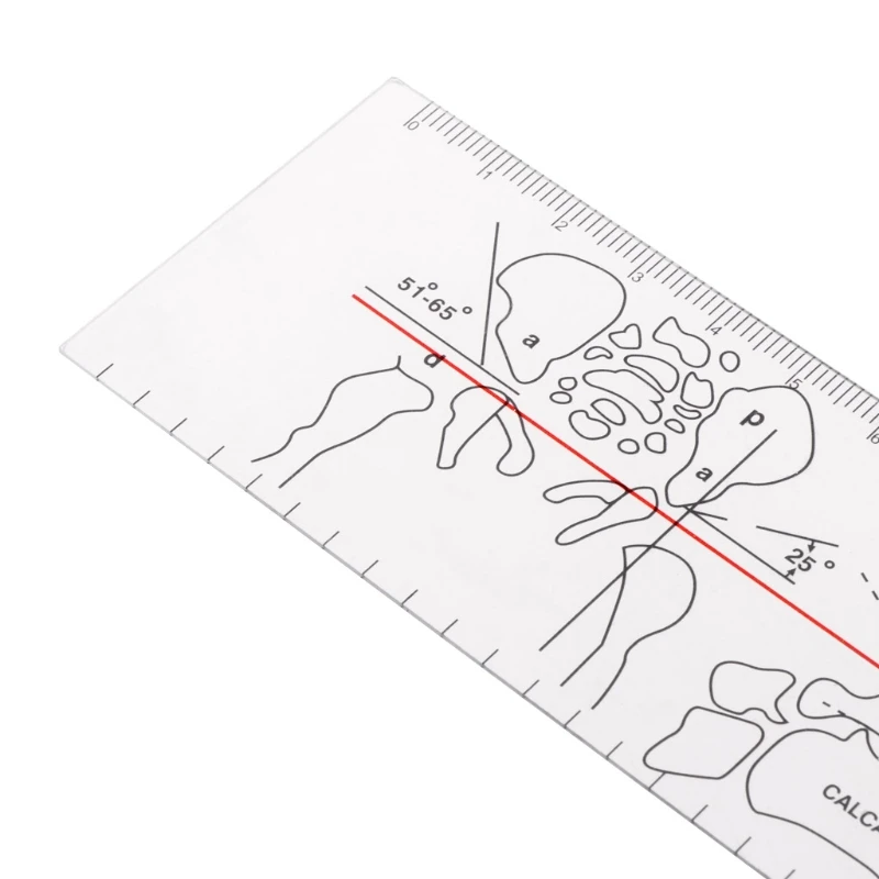 Goniometer Angle Ruler Rule Joint Orthopedics Tool Instruments Plastic