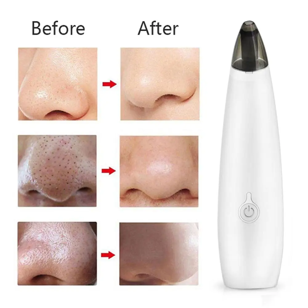 

Deep Blackhead Acne Removal Vacuum Dark Black Head Face Skin Cleaner Nose Pimple Care Suction Electric Extractor Battery Style