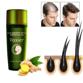 Ginger Hair Growth Essence Oil Serum Anti Hair Loss Products Fast Grow Nourish Soften Hair Roots Scalp Repair Damaged Thin Care