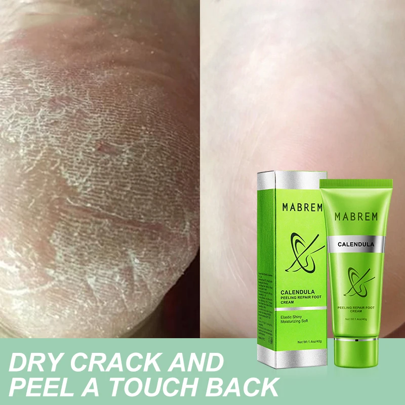 

Hot Calendula Nourishing Heel Crack Repair Cream Anti Crack Foot Peeling Cracked Hands Feet Dry Foot Cream Foot Care 40g TSLM1