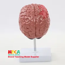 Патология человека мозговая Цереброваскулярная модель головного мозга для пожилых людей обучение медицине Mdn008
