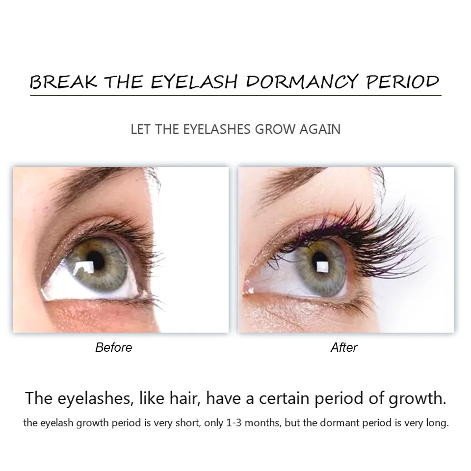 FEG Eyelash Growth Serum Eyelash Growth Treatment Serum Natural Medicine Eyelash Growth Enhancer Lengthening Longer