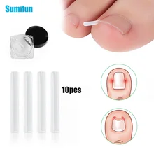 

10pcs/box Ingrown Toenail Correction Tool Invisible Ingrown Toe Nail Padding Elastic Straightening Clip Brace Pedicure Tool