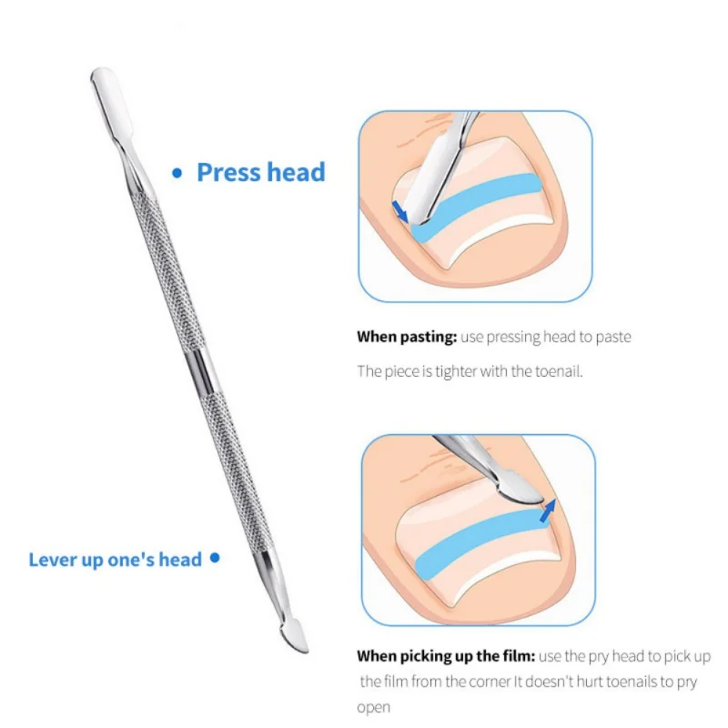 Вросший ноготь, набор для коррекции ноготь, инструмент для лечения ноготков, выпрямление ногтей, пластырь, инструмент для восстановления ног, набор для ухода за ногами
