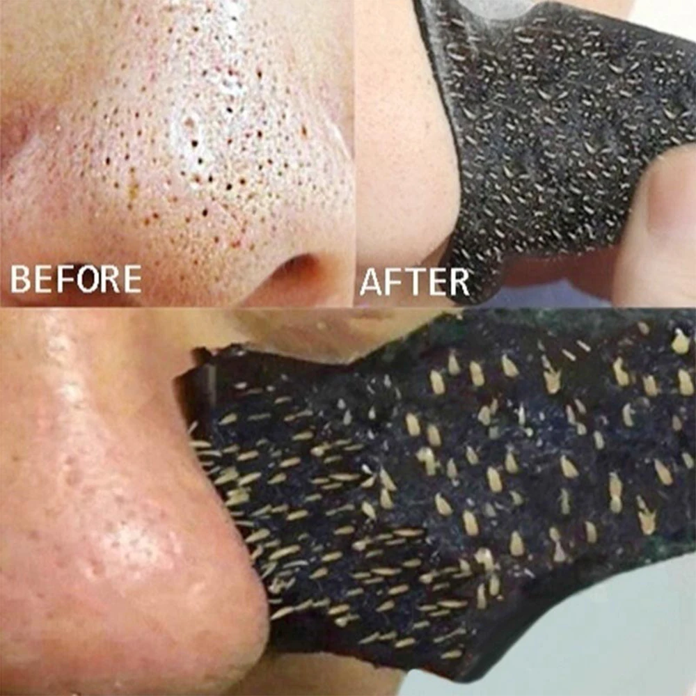 Effective Blackheads Removal Mask Nose Purifying Deep Cleaning 10pcs Black Pore Contraction T District Care Water Hydrating | Красота и