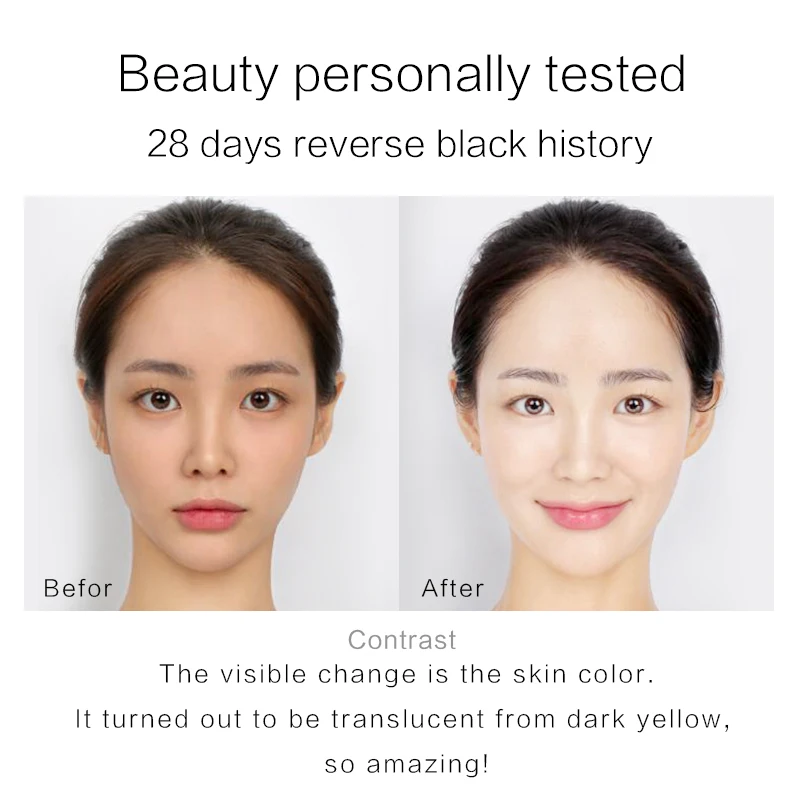Fonce Сыворотка для лица 30 мл Niacinamide Essence осветляет тоник для кожи витамин В5 увлажненитель с гиалуроновой кислотой светло-белая бутылка