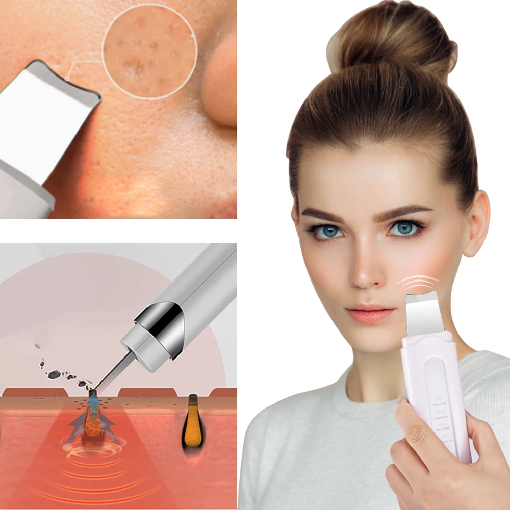 Ultrasonic Facial Skin Cleaner Exfoliating Pore Removal Blackhead Acne Peeling Vibration Face Massager Skin Scrubber 2