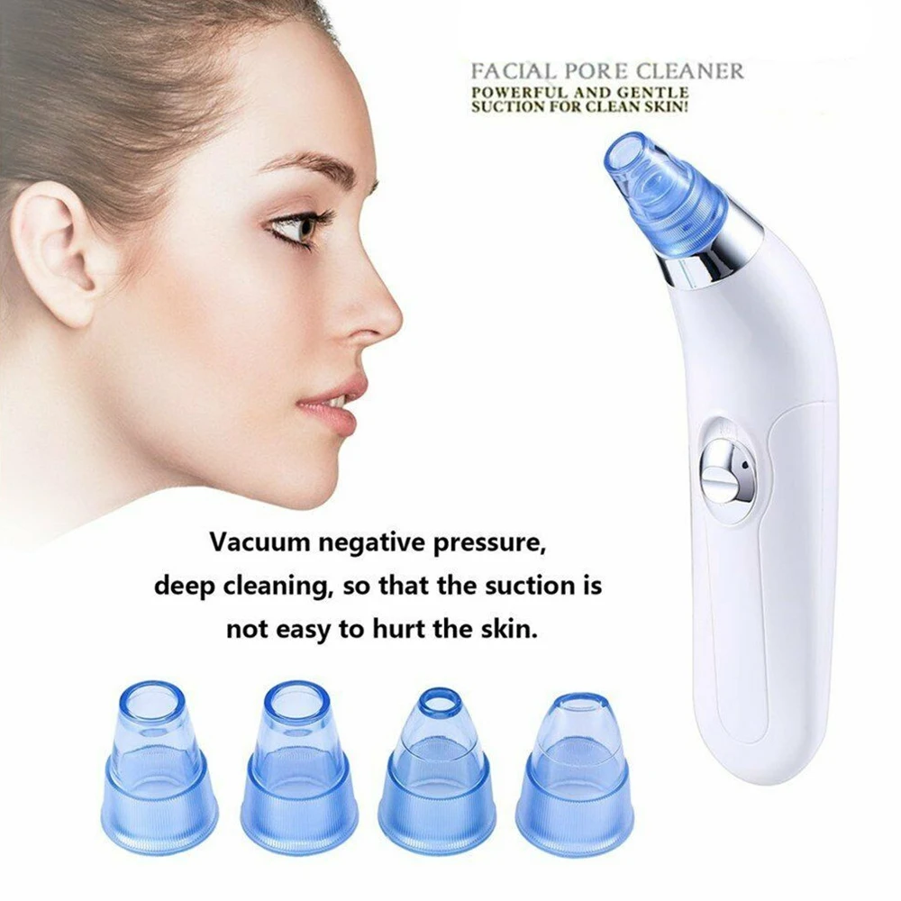 H23658c9810974c8881a8c6fd61ab6607u Beauty-Health Blackhead Remover Vaccum Suction Facial Cleaner