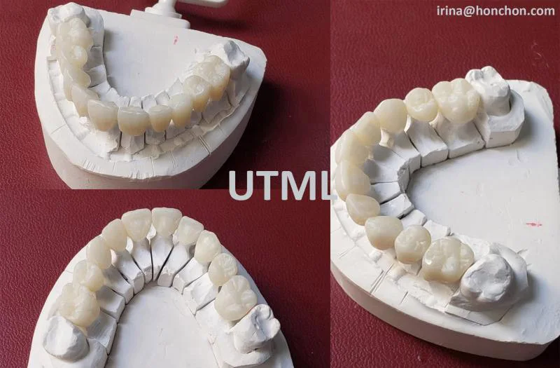 1 шт. UTML 95x14 мм Zirkonzahn CAD CAM многослойный циркониевый Блок