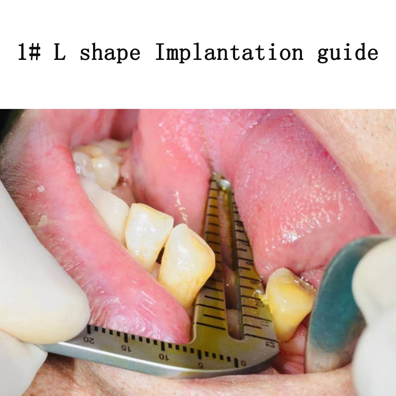 Dentist tools planting positioning angle ruler Dental implants instruments oral planting positioning guide dental implant tools 4