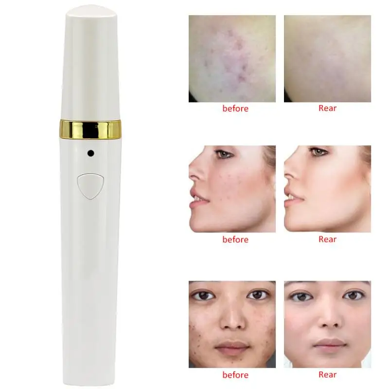 Electric Blackhead Magic Acne Remover Cleaner Remover Facial Skin Care