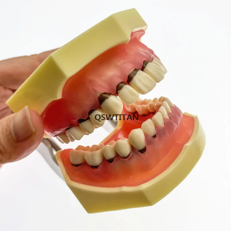 adulto patológico doença periodontal para simulação oral modelo de dentes