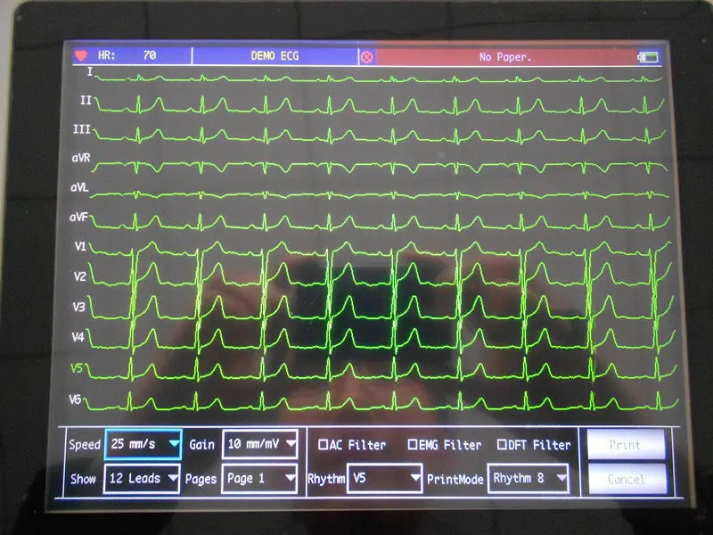 CONTEC ECG1200G цифровой 12 каналов/свинец EKG+ ПК синхронизация программного обеспечения, электрокардиограф CE, FDA сенсорный экран