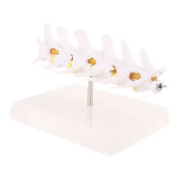 

Dog Canine Lumbar Disc Herniation Model Aid Teaching Anatomy Instruments Study Research Display