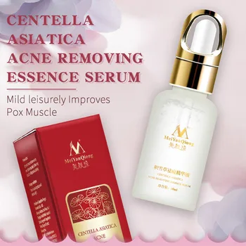 

Centella Asiatica Acne Essence Hydrating Anti-Inflammatory Control Oil Pimples Removal Liquid
