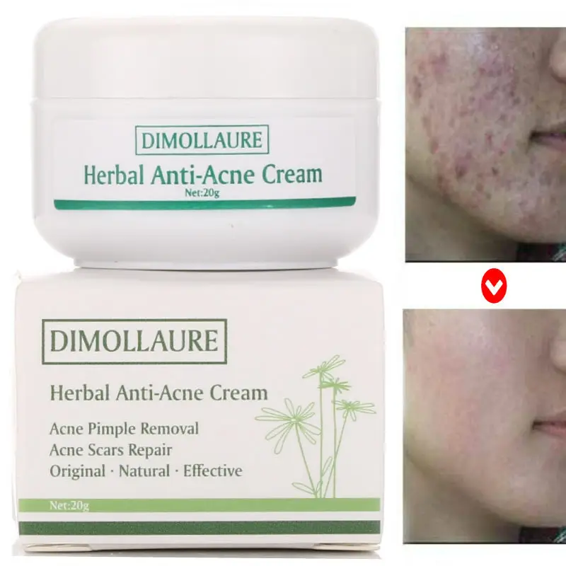 herbal pimple cream
