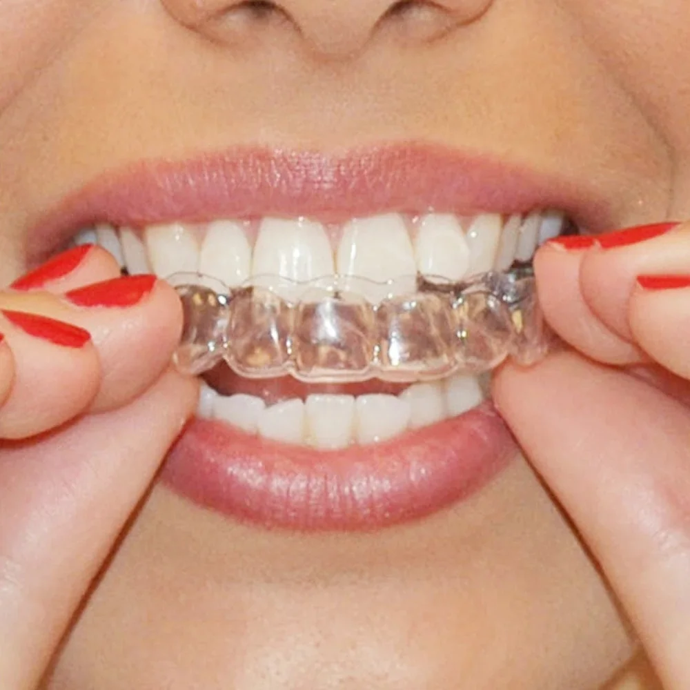 2 пары подносы для отбеливания зубов|oral hygiene|tooth whiteningteeth whitening tray |