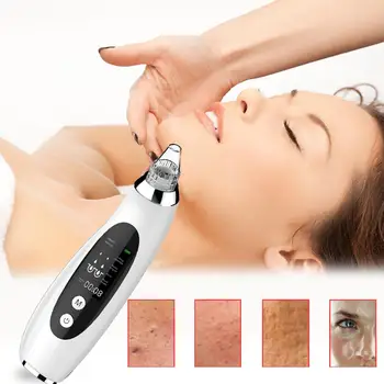 

USB Vacuum Suction Blackhead Remover Nose Facial Pore Cleaner Spot Acne Black Head Pimple Removal Face Beauty Tools
