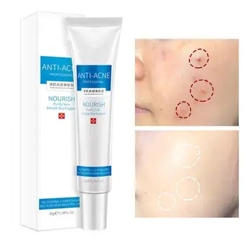 

1/2pcs 30g Skin Care Treatment Anti-acne Cream Acne Oil-Control Acne Treatment Moisturizing Pores Shrink Anti-ance Cream