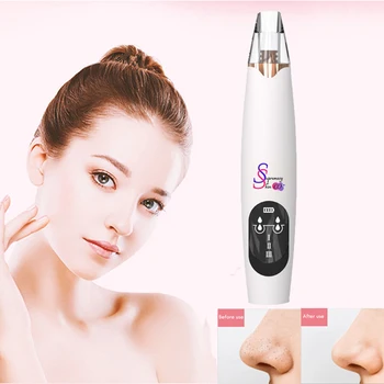 

Blackhead Remover wart remover ultrasonic facial cleanser Nose Pore cleansing Vacuum removal of black dots tool