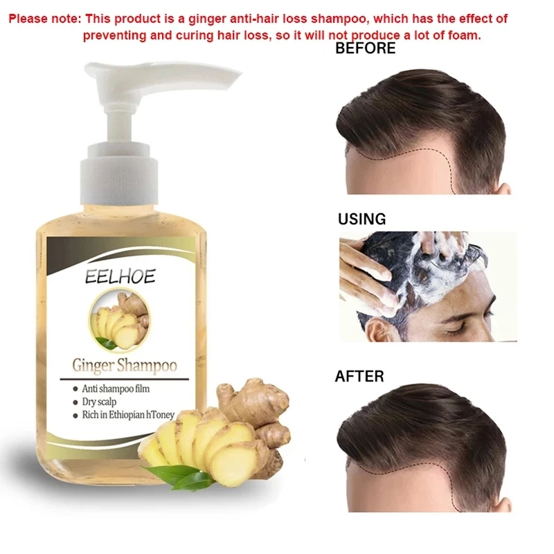 Ginseng-Anti-Haarausfall-Shampoo-Leistungsstarke-Behandlung-Haarpflege-Wachstum-Essenz-Kr-uter-Ingwer-K-hler-Haar-Wachstum.jpg_Q90.jpg_.webp