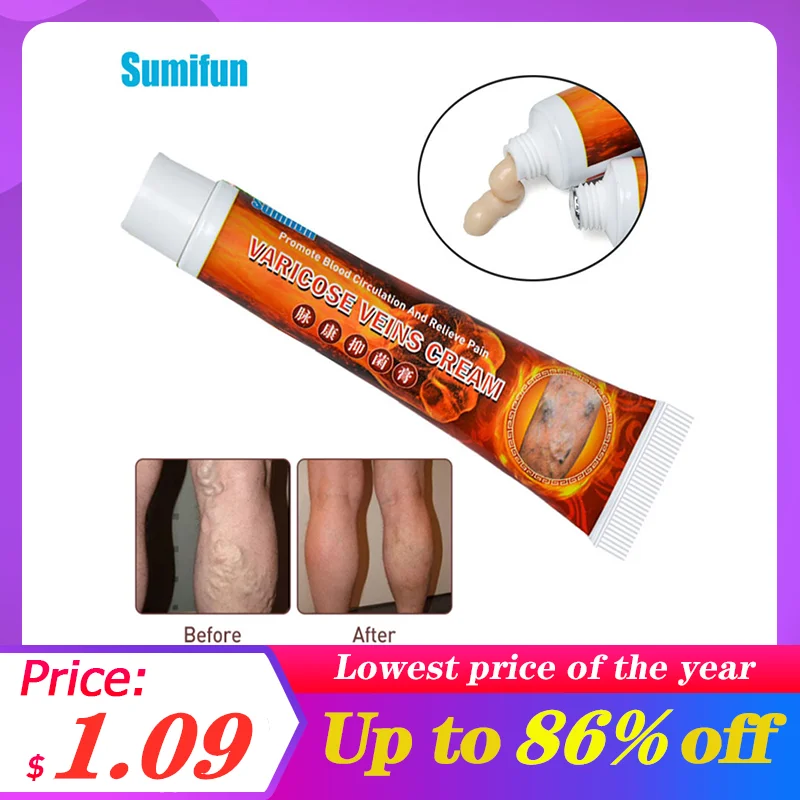 Sumifun 1 шт. 20g варикозное расширение вен лечение крем ангиит средство мазь рельеф