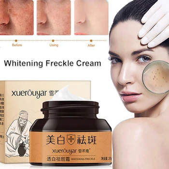 

Freckle Cream Strong Effects Whitening Moisturizing Remove Melasma Acne Spots Pigment Melanin Dark Spots Face Skin Care Cream