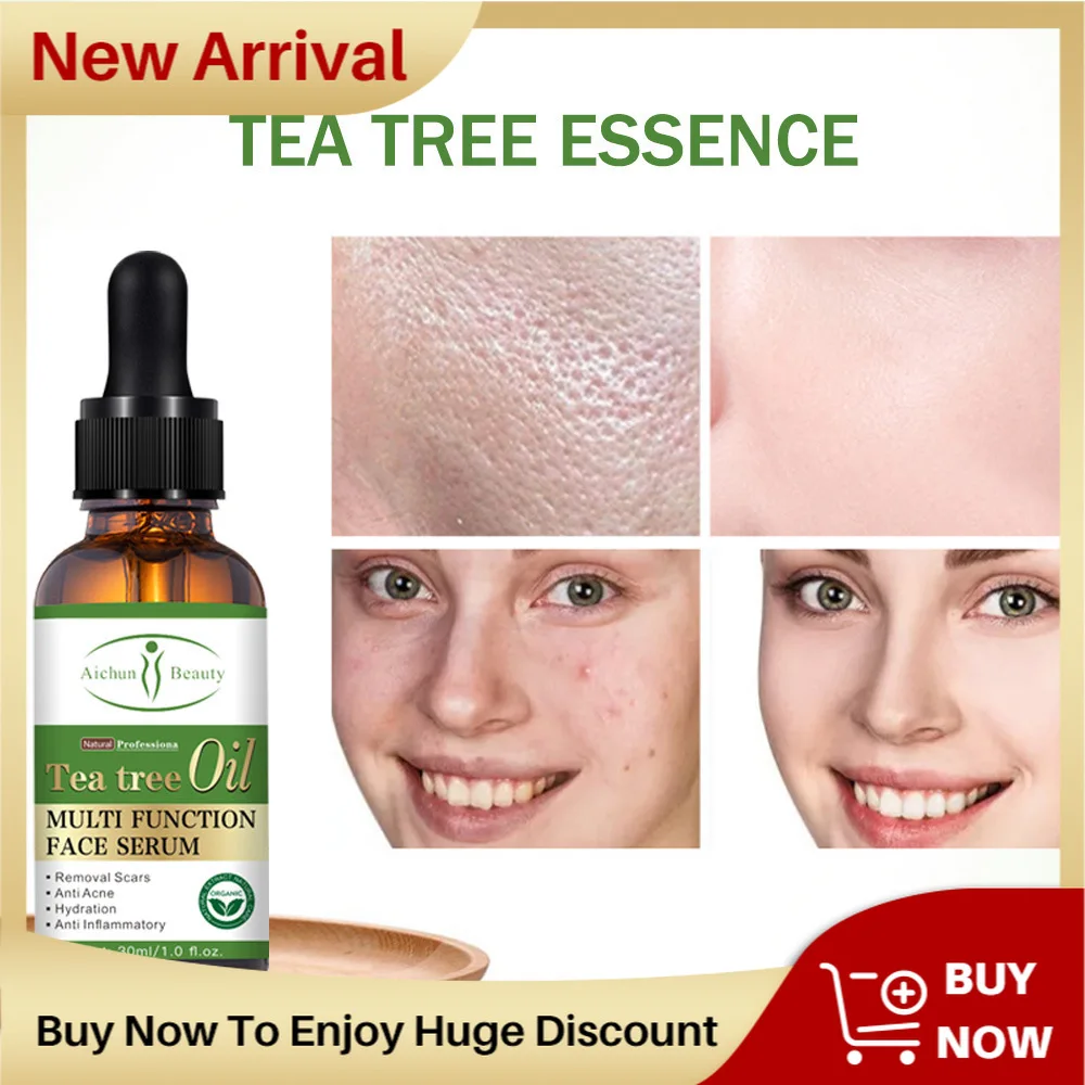 

30ml Acne Treatment Face Serum Mask Anti Acne Pimple Scar Remover Moisturizing Whitening Skin Care Facial Essence Cream