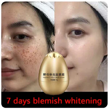 

Powerful whitening freckle cream moisturizing mask cream to remove freckles and dark spots 30g skin whitening cream
