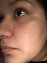 Eliminador de espinillas por calor, aspiradora de poros para nariz, cara, acné, succión, pantalla LCD recargable, herramientas de eliminación de puntos de succión