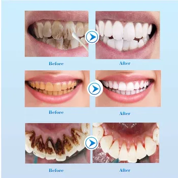 

Newly Teeth Whitening Liquid Oral Hygiene Removes Plaque Stains Tooth Cleaning Essence CTN88