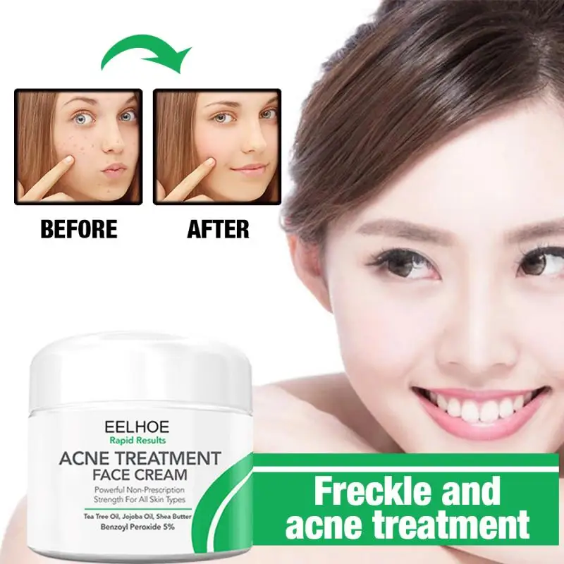 eelhoe scar removal cream