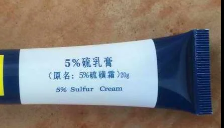 

5% sulfur cream ointment original name sulfur cream acne rosacea children acne and other genuine 20g