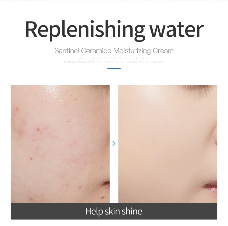 OEM/ODM anti wrinkle skin whitening face cream