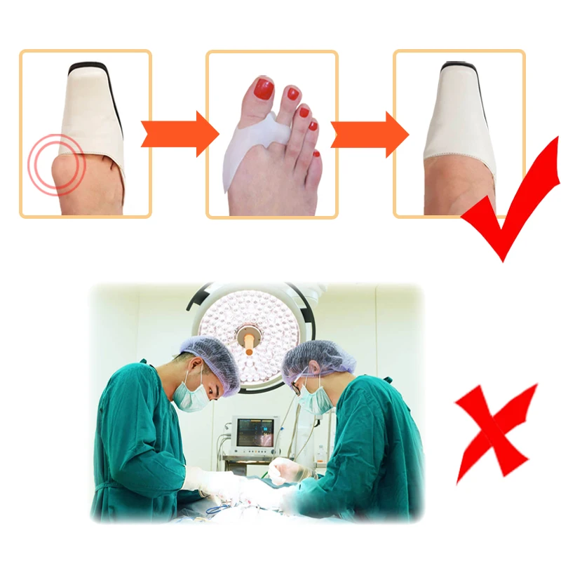 2Pcs Big Toe Bone Straightener Thumb Valgus Protector Silicone Gel Foot Care Fingers Toe Separator Bunion Adjuster Feet Massager
