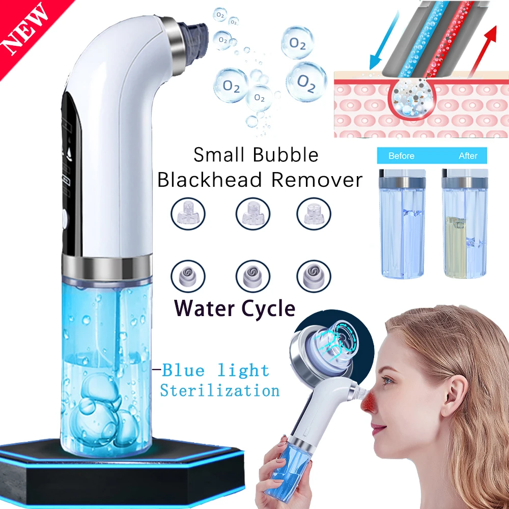 Cleaning-Remover-Tool Blackhead-Cleaner Skin-Care Acne-Pimple Poros Vacuum-Pore Water-Cycle