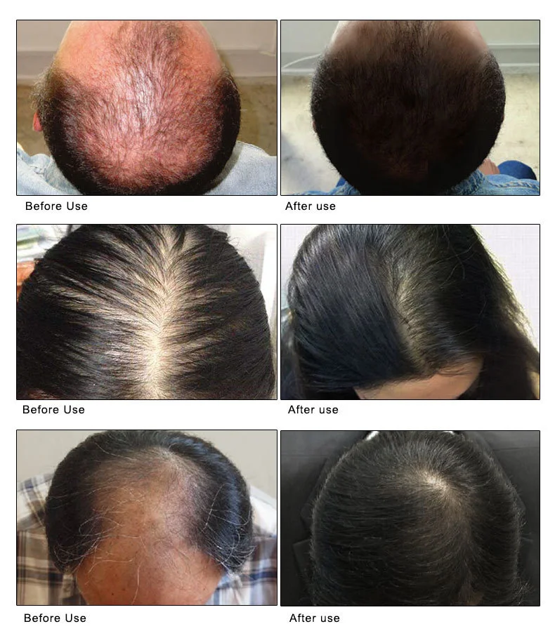 hair_09