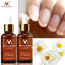 Лечение грибковых ногтей, уход за ногами, эссенция для ногтей, отбеливание ног, удаление грибка ногтей, гель против инфекции, парониксия, онихомикоз