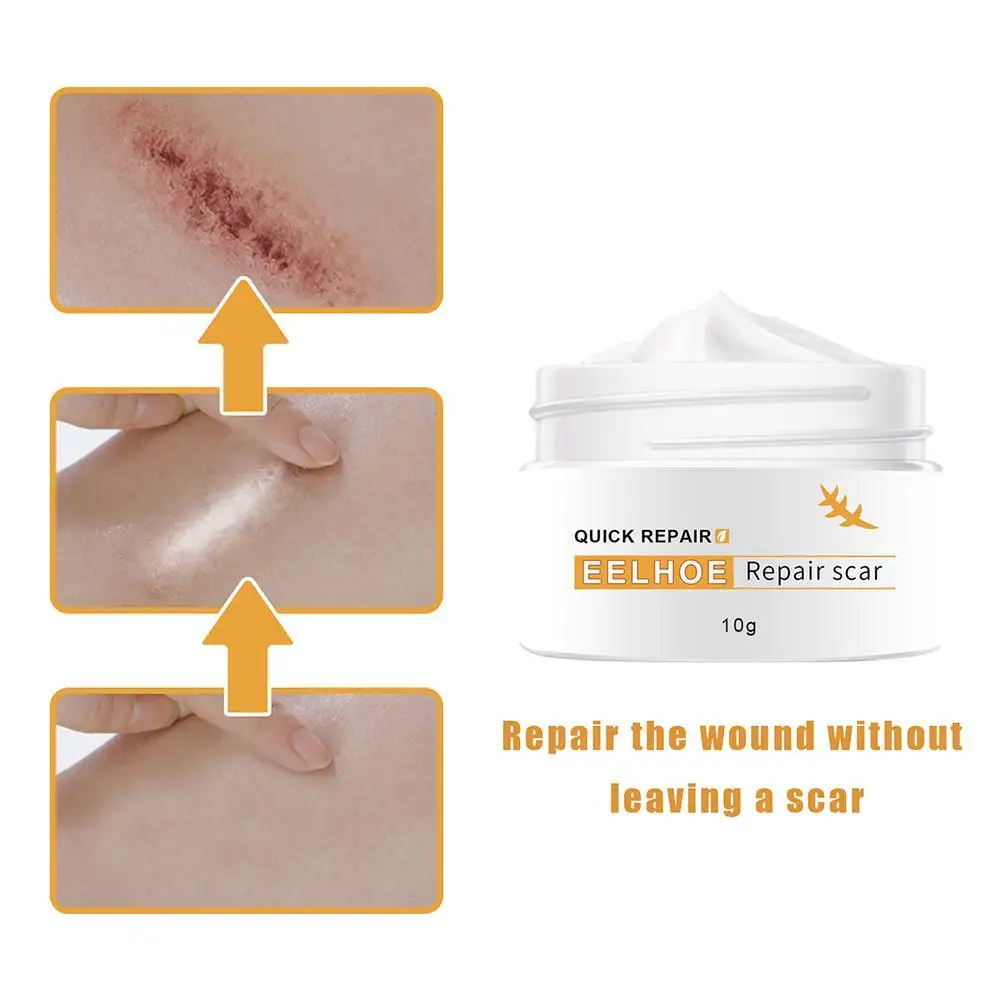 H250175990e3a4b2fa25867b52aacfde4D Crocodile Repair Scar Face Cream Removal Acne Spots Whitening Skin for Scald and Surgical Scar Stretch Marks