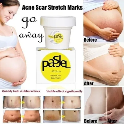 

Body Cream Bleaching Whitening Cream Skin Body Lotion Moisturizing Deep Skin Bleaching Cream Lightening Cream Body Anti Aging