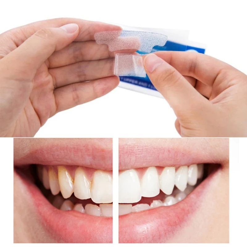 Tooth Paste to Yellow Teeth Dirty Teeth Whitening Whitening Tooth Paste Teeth Set