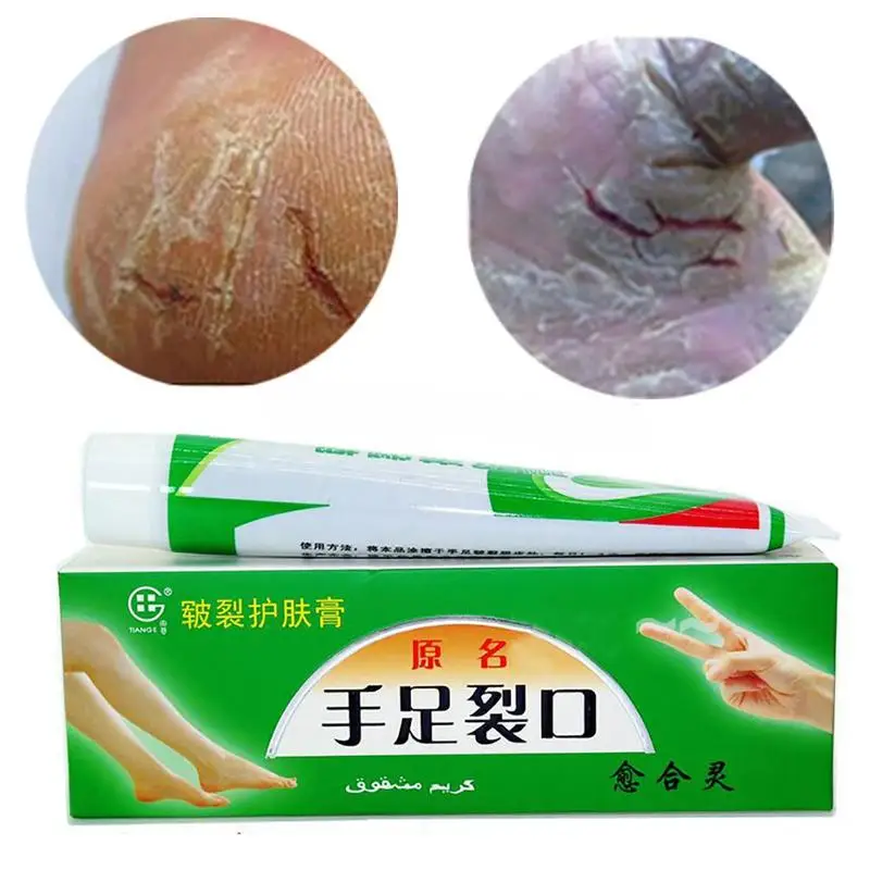 

Hand Foot Crack Cream Heel Chapped Peeling Repair Anti Dry Crack Winter Feet Care Chinese Medicinal Ointment Cream 25g