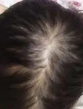 Sevich-espray de esencia para el crecimiento del cabello para hombres y mujeres, tratamiento para la pérdida del cabello, nutre las raíces, fácil de llevar, cuidado del cabello Germinal rápido, 30g