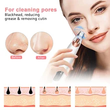 

3 suction heads, rechargeable three-gear vacuum pore plucker, blackhead export beauty instrument, facial pore cleaner