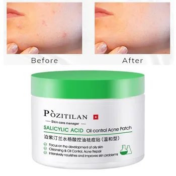 

Acne Treatment Pads Cotton Patch Treatment Of Acne Skin Face And Neck Available Tablets 55 PCS Facial Cleaning Wipes