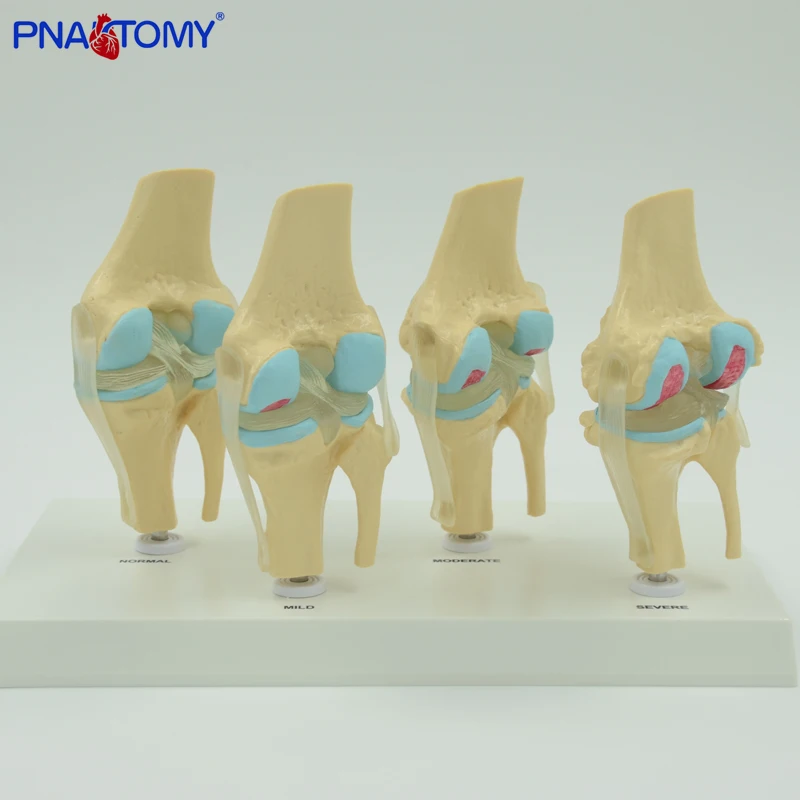 

Knee Joints Synthesis Model,life Size Anatomical Model Anatomy Specimen Medical Sciences Educational Equipment